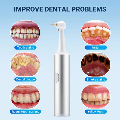 Electric Dental Teeth Polisher Teeth Cleaner Oral Calculus Cleaning